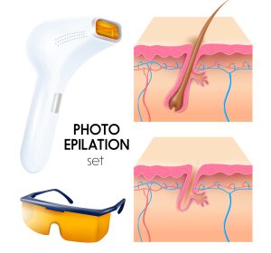Photo epilation realistic set with epilator protective goggles and cross section of skin layers scheme vector illustration